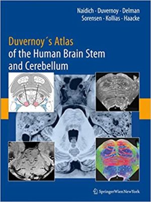 Duvernoys Atlas of the Human Brain Stem and Cerebellum High Field MRI Surface Anatomy Internal Structure Vascularization and 3D Sectional Anatomy