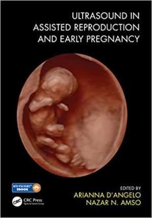 Ultrasound in Assisted Reproduction and Early Pregnancy