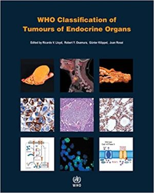 WHO Classification of Tumours of Endocrine Organs 4th Edition