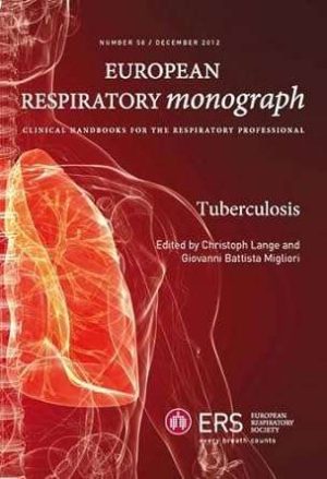 Tuberculosis By G B Migliori